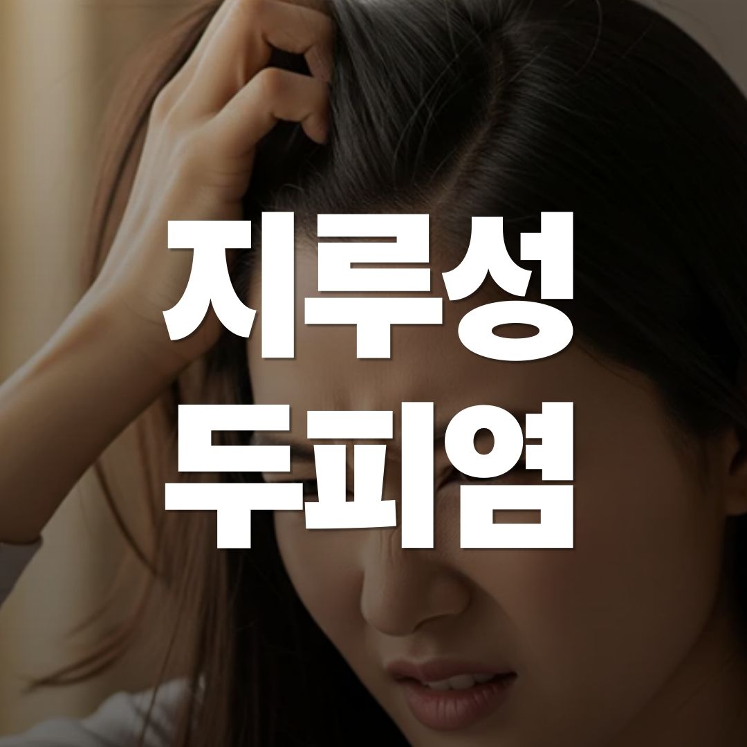 지루성 두피염 증상 삼푸, 안티트로 샴푸 효과, 관리방법 가이드