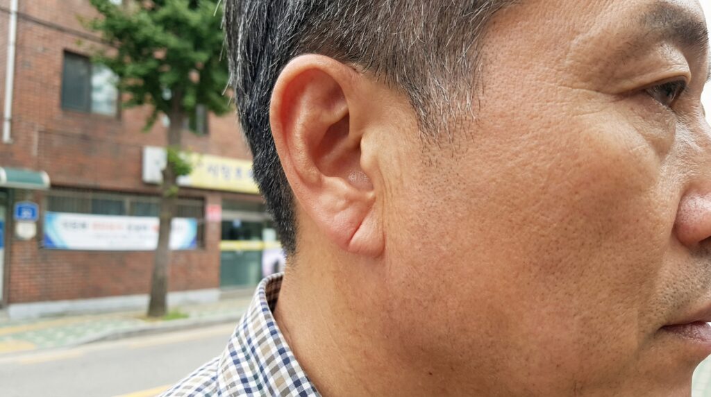 중년 남성 귓볼의 대각선 주름 클로즈업