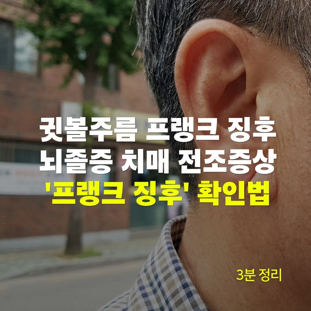 귓볼주름 발견된 프랭크 징후 뇌졸증 치매 전조증상 프랭크 징후 확인법